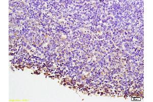 Formalin-fixed and paraffin embedded mouse lymphoma labeled with Anti-NFATC1/NFAT2 Polyclonal Antibody, Unconjugated (ABIN686257) at 1:200 followed by conjugation to the secondary antibody and DAB staining. (NFATC1 抗体  (AA 601-716))
