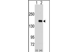 Western blot analysis of PUM2 (arrow) using rabbit polyclonal PUM2 Antibody (N-term) (ABIN391821 and ABIN2841667). (PUM2 抗体  (N-Term))