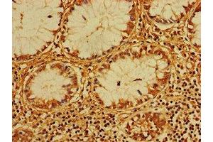 Immunohistochemistry (IHC) image for anti-Ceramide Kinase (CERK) (AA 212-478) antibody (ABIN7147455)