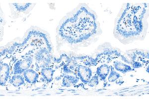 Immunohistochemistry (IHC) image for anti-CD28 (CD28) (AA 170-220) antibody (ABIN7455122) (Recombinant CD28 抗体  (AA 170-220))