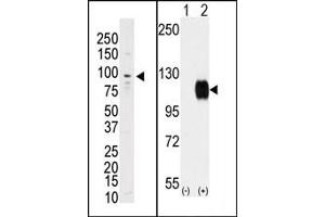 Image no. 1 for anti-TYRO3 Protein Tyrosine Kinase (TYRO3) (C-Term) antibody (ABIN359940) (TYRO3 抗体  (C-Term))
