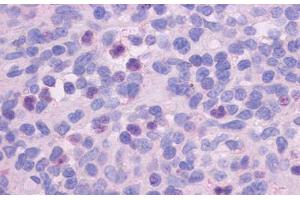 Anti-FPR1 antibody  ABIN1048601 IHC staining of human spleen. (FPR1 抗体  (Extracellular Domain))