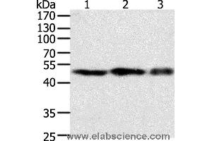 Western blot analysis of NIH/3T3, 293T and Jurkat cell, using F7 Polyclonal Antibody at dilution of 1:400 (Factor VII 抗体)