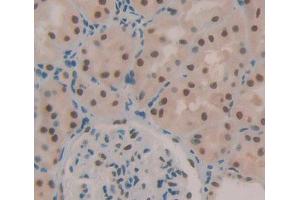 Used in DAB staining on fromalin fixed paraffin- embedded kidney tissue (TCEA1 抗体  (AA 1-228))