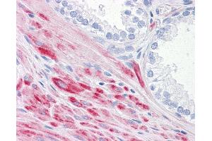 Anti-ADAMTS17 antibody IHC of human prostate.