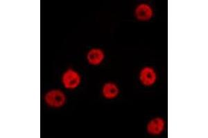ABIN6277656 staining Hela by IF/ICC. (ZEB1 抗体  (Internal Region))