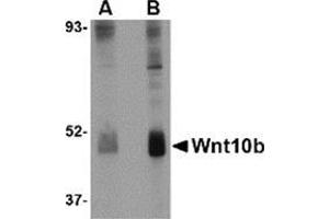 Western blot analysis of Wnt10b in human skeletal muscle tissue lysate with this product at (A) 2 and (B) 4 μg/ml. (WNT10B 抗体  (Center))