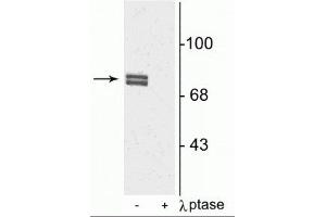 Western blot of rat cortical lysate showing specific immunolabeling of the ~80 kDa doublet of 5-LO phosphorylated at Ser523 in the first lane (-). (ALOX5 抗体  (pSer523))