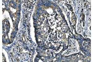 IHC analysis of CX3CR1 using anti-CX3CR1 antibody (ABIN7599293).