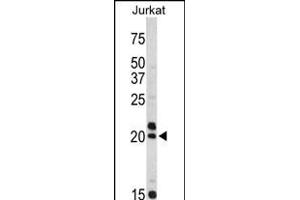 Western blot analysis of VIP antibody (C-term) (ABIN390468 and ABIN2840836) in Jurkat cell line lysates (35 μg/lane). (Vip 抗体  (C-Term))