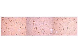 Immunohistochemistry: 1:50-1:300 working dilutions of anti-Prion Protein, clone 2G11 localizes prion protein in rat brain paraffin embedded tissue (High & Low Magnification). (PRNP 抗体)