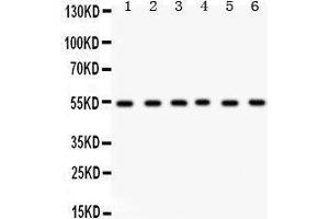 Western Blotting (WB) image for anti-Dihydrolipoamide Dehydrogenase (DLD) (AA 300-509) antibody (ABIN3043561) (DLD 抗体  (AA 300-509))