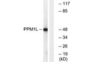 Western Blotting (WB) image for anti-Protein Phosphatase, Mg2+/Mn2+ Dependent, 1L (PPM1L) (AA 119-168) antibody (ABIN2890546) (PPM1L 抗体  (AA 119-168))
