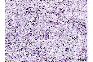 anti-Human Papilloma Virus 16 E6 (HPV-16 E6) (AA 85-158) antibody