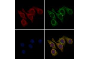 ABIN7094784 and ABIN7098835 staining Hela cells by IF/ICC. (RGMA 抗体  (Internal Region))