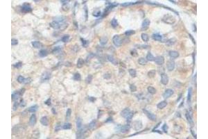 Immunohistochemical analysis of paraffin-embedded human fetal testis showing cytoplasmic staining with ACOT9 polyclonal antibody  at a 1 : 100 dilution. (ACOT9 抗体  (AA 3-212))