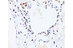 Immunohistochemistry of paraffin-embedded Human lung using BRIX1 Polyclonal Antibody at dilution of 1:100 (40x lens). (BRIX1 抗体)