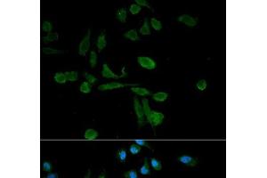 Immunofluorescence analysis of HeLa cells using SIRT7 Polyclonal Antibody (SIRT7 抗体)