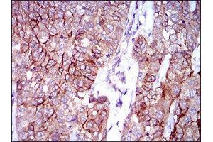 Immunohistochemistry (IHC) image for anti-Activated Leukocyte Cell Adhesion Molecule (ALCAM) (AA 48-216) antibody (ABIN1846221) (CD166 抗体  (AA 48-216))