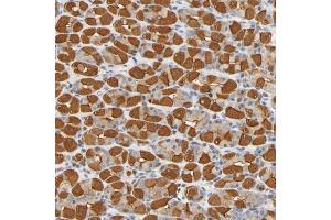 Immunohistochemical staining (Formalin-fixed paraffin-embedded sections) of human stomach shows strong cytoplasmic positivity in glandular cells. (UCKL1 抗体  (AA 86-203))