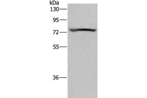 Western Blotting (WB) image for anti-Potassium Voltage-Gated Channel, KQT-Like Subfamily, Member 1 (KCNQ1) antibody (ABIN7241600)