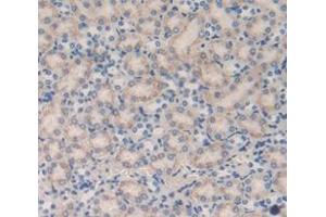IHC-P analysis of Mouse Tissue, with DAB staining. (CUBN 抗体  (AA 3511-3623))