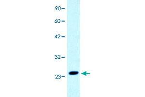 Western Blot analysis of Jurkat cell lysate with C1orf149 polyclonal antibody  at 0. (MEAF6 抗体  (N-Term))