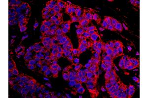 Immunofluorescence (IF) image for anti-Cancer Susceptibility Candidate 3 (CASC3) (AA 653-703) antibody (ABIN7448936) (CASC3 抗体  (AA 653-703))