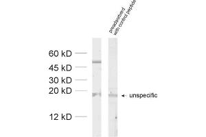 Western Blotting (WB) image for anti-gamma-aminobutyric Acid (GABA) A Receptor, alpha 2 (GABRA2) (AA 29-37) antibody (ABIN1742453)