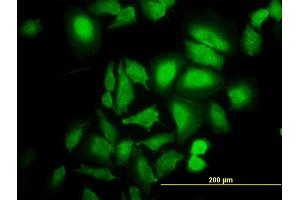 Immunofluorescence of monoclonal antibody to ABL2 on HeLa cell. (ABL2 抗体  (AA 743-842))