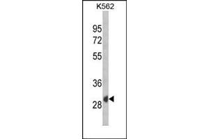 Western blot analysis of SFRP1 Antibody (N-term) Cat. (SFRP1 抗体  (N-Term))