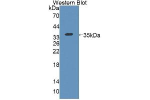 Western blot analysis of the recombinant protein. (KEL 抗体  (AA 439-713))