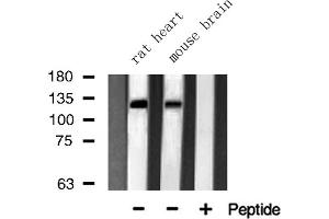 Western blot analysis of JMY using Jurkat whole cell lysates (JMY 抗体  (C-Term))