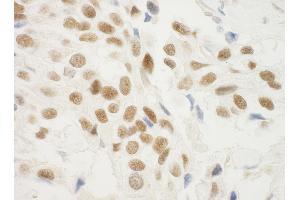 anti-Zinc Finger Protein 768 (ZNF768) (AA 1-15) antibody