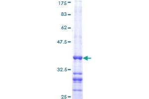 GTPase NRas Protein (NRAS) (AA 90-189) (GST tag)