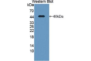 Western blot analysis of the recombinant protein. (POR 抗体  (AA 210-578))