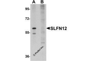 Western Blotting (WB) image for anti-Schlafen Family Member 12 (SLFN12) (C-Term) antibody (ABIN1030678) (SLFN12 抗体  (C-Term))