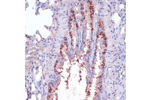 Immunohistochemistry of paraffin-embedded rat lung using RPL22 antibody (ABIN6128682, ABIN6147119, ABIN6147120 and ABIN6224925) at dilution of 1:100 (40x lens). (RPL22 抗体  (AA 1-122))