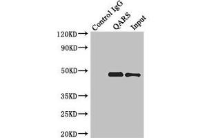 Immunoprecipitating ENTPD5 in Hela whole cell lysate Lane 1: Rabbit control IgG instead of (1 μg) instead of ABIN7151376 in Hela whole cell lysate. (ENTPD5 抗体  (AA 149-428))