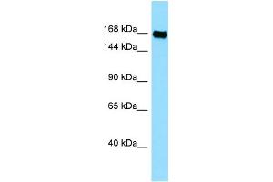 WB Suggested Anti-PLXNB3 Antibody Titration: 1. (Plexin B3 抗体  (C-Term))