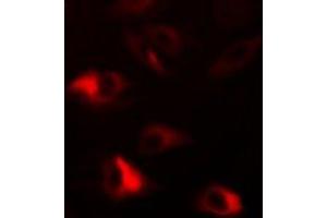 Immunofluorescent analysis of Peroxiredoxin 2 staining in HepG2 cells. (Peroxiredoxin 2 抗体)