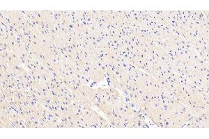 Immunohistochemistry (IHC) image for anti-Mitogen-Activated Protein Kinase 8 (MAPK8) (AA 145-419) antibody (ABIN7439321)