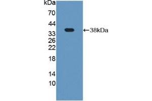 Western blot analysis of recombinant Rat Plg. (PLG 抗体  (AA 191-433))