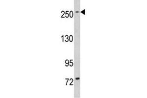 Western blot analysis of LRRK1 in mouse bladder tissue lysate (LRRK1 抗体  (AA 1981-2015))