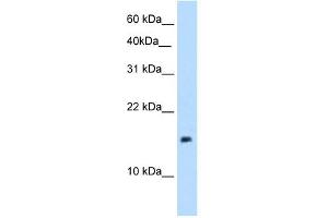 PAGE1 antibody used at 5 ug/ml to detect target protein. (PAGE1 抗体)