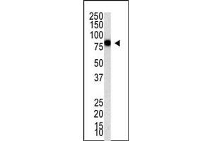Image no. 1 for anti-Protein Inhibitor of Activated STAT, 4 (PIAS4) (C-Term) antibody (ABIN356771) (PIAS4 抗体  (C-Term))