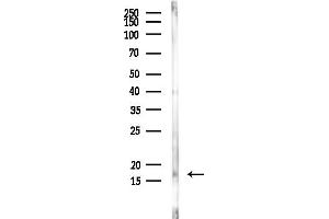 Western blot analysis of lysates from Rat liver, using MYL6 Antibody at 1/1000 dilution.