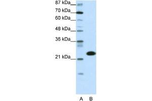 Transfected 293T; WB Suggested Anti-TAF11 Antibody Titration: 0. (TAF11 抗体  (N-Term))