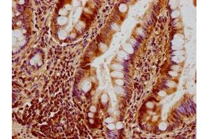 IHC image of ABIN7150845 diluted at 1:300 and staining in paraffin-embedded human small intestine tissue performed on a Leica BondTM system. (OPA1 抗体  (AA 183-418))