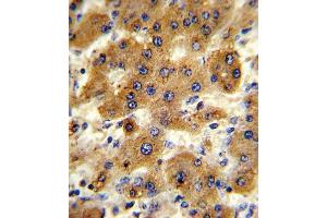 Immunohistochemistry (Paraffin-embedded Sections) (IHC (p)) image for anti-Cytochrome P450, Family 8, Subfamily B, Polypeptide 1 (CYP8B1) (AA 471-501), (C-Term) antibody (ABIN652734)